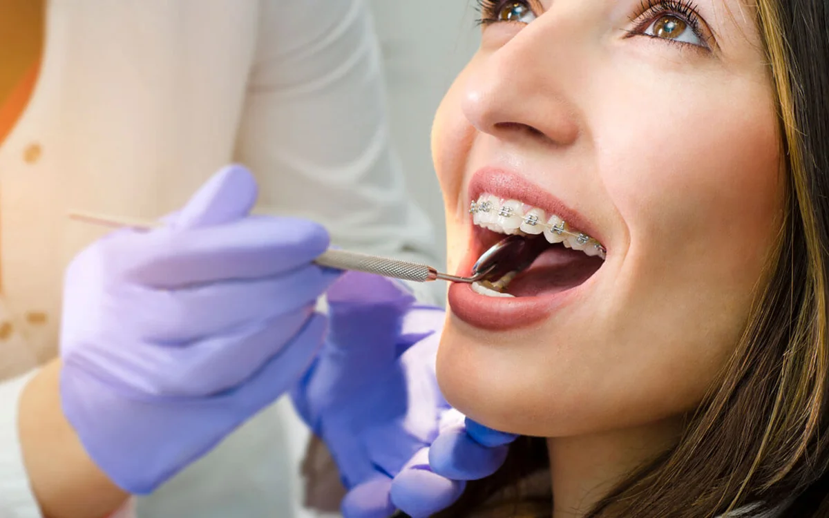 Orthodontic Treatment (Braces & Aligners)