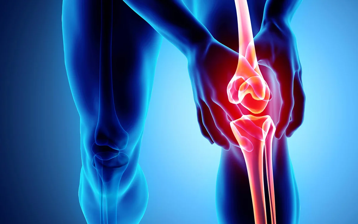 Total Knee Replacement