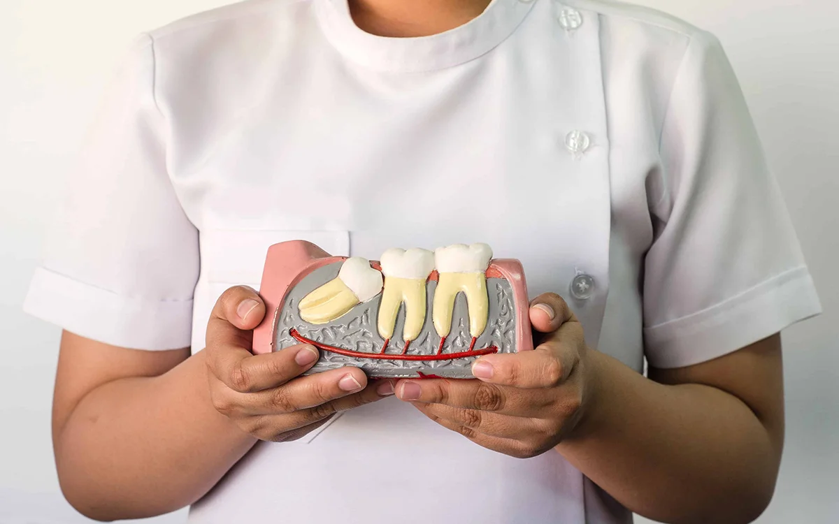 Wisdom Tooth Extraction
